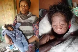 Une Sud-Africaine de 20 ans met au monde une fille atteinte de la progéria @the-sun.com