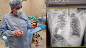 Un soldat ukrainien se fait retirer une grenade réelle du torse