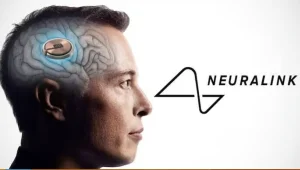 Neuralink, la société d’Elon Musk, a posé une puce dans le cerveau d’un humain