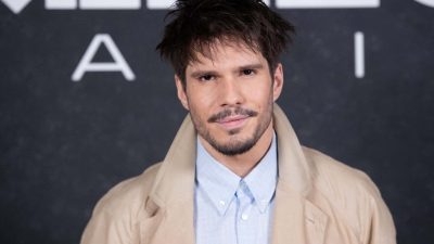 François Civil : hyperactivité, stress, dépigmentation… son corps dit stop