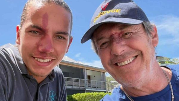 Jean-Luc Reichmann : 14 ans après leur première rencontre, l'animateur retrouve Gabin lui aussi marqué par un angiome sur le visage