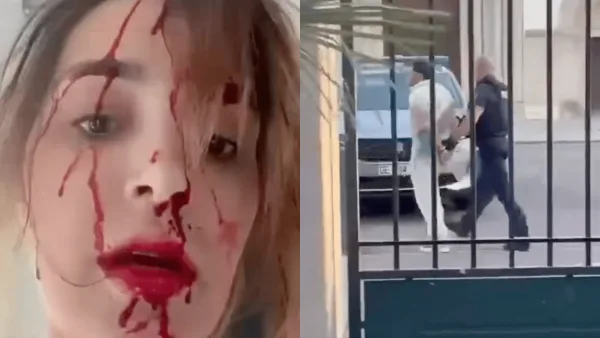 Cannes 2026 : une Miss violemment agressée dans sa chambre d’hôtel, son visage en sang dévoilé, son styliste interpellé