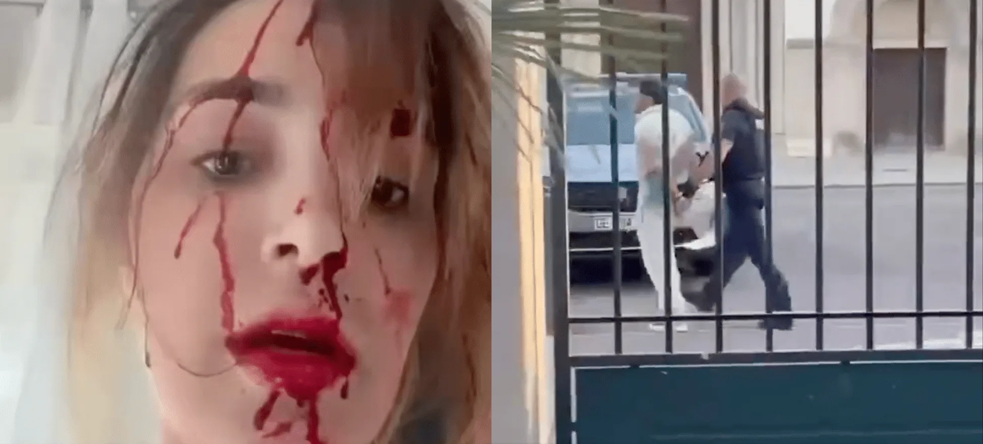 Cannes 2026 : une Miss violemment agressée dans sa chambre d’hôtel, son visage en sang dévoilé, son styliste interpellé