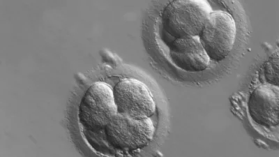 Embryons humains observés lors d’une fécondation in vitro